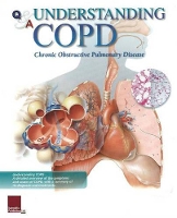 Book Cover for Understanding COPD Flip Chart by Scientific Publishing