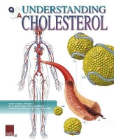 Book Cover for Understanding Cholesterol Flip Chart by Scientific Publishing