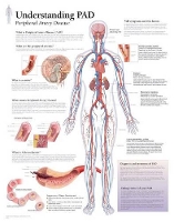 Book Cover for Understanding PAD Laminated Poster by Scientific Publishing