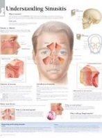 Book Cover for Understanding Sinusitis Laminated Poster by Scientific Publishing