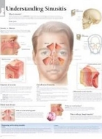 Book Cover for Understanding Sinusitis Paper Poster by Scientific Publishing