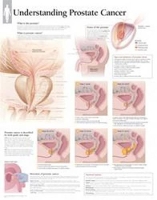 Book Cover for Understanding Prostate Cancer Paper Poster by Scientific Publishing