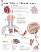 Book Cover for Atrial Fib & Ischemic Strokes Laminated Poster by Scientific Publishing