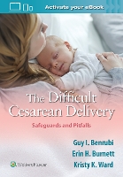 Book Cover for The Difficult Cesarean Delivery: Safeguards and Pitfalls by Guy I. Benrubi