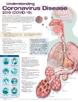 Book Cover for Understanding Coronavirus Disease 2019 (COVID-19) Anatomical Chart by Anatomical Chart Company