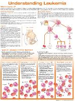 Book Cover for Understanding Leukemia Anatomical Chart by Anatomical Chart Company