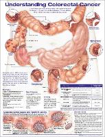 Book Cover for Understanding Colorectal Cancer Anatomical Chart by Anatomical Chart Company