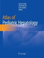 Book Cover for Atlas of Pediatric Hepatology by Deirdre Kelly