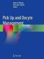 Book Cover for Pick Up and Oocyte Management by Antonio Malvasi