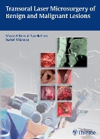 Book Cover for Transoral Laser Microsurgery of Benign and Malignant Lesions by Manuel Bernal-Sprekelsen