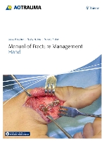 Book Cover for Manual of Fracture Management - Hand by Jesse B. Jupiter