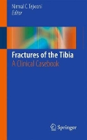 Book Cover for Fractures of the Tibia by Nirmal C. Tejwani