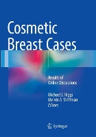 Book Cover for Cosmetic Breast Cases by Michael J. Higgs