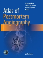 Book Cover for Atlas of Postmortem Angiography by Silke Grabherr