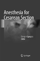 Book Cover for Anesthesia for Cesarean Section by Giorgio Capogna