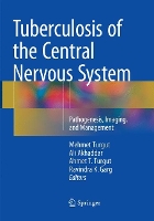 Book Cover for Tuberculosis of the Central Nervous System by Mehmet Turgut