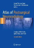 Book Cover for Atlas of Postsurgical Neuroradiology by Daniel Thomas Ginat