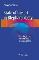 Book Cover for State of the art in Blepharoplasty by Paraskevas Kontoes