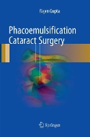 Book Cover for Phacoemulsification Cataract Surgery by Rajen Gupta