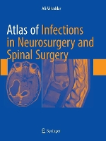 Book Cover for Atlas of Infections in Neurosurgery and Spinal Surgery by Ali Akhaddar