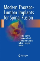 Book Cover for Modern Thoraco-Lumbar Implants for Spinal Fusion by Roberto Delfini