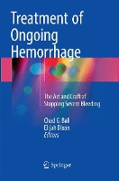 Book Cover for Treatment of Ongoing Hemorrhage by Chad G. Ball