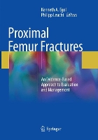 Book Cover for Proximal Femur Fractures by Kenneth A. Egol