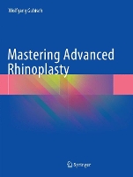 Book Cover for Mastering Advanced Rhinoplasty by Wolfgang Gubisch