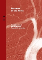 Book Cover for Diseases of the Aorta by Frantisek Sabol
