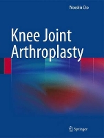 Book Cover for Knee Joint Arthroplasty by Wooshin Cho