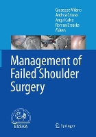 Book Cover for Management of Failed Shoulder Surgery by Giuseppe Milano