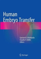 Book Cover for Human Embryo Transfer by Gautam N. Allahbadia