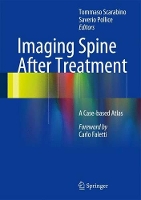 Book Cover for Imaging Spine After Treatment by Tommaso Scarabino