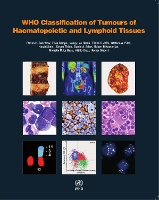 Book Cover for WHO classification of tumours of haematopoietic and lymphoid tissues by International Agency for Research on Cancer