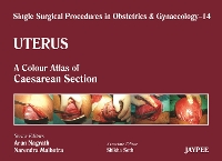 Book Cover for Single Surgical Procedures in Obstetrics and Gynaecology - Volume 14 - Uterus by Arun Nagrath