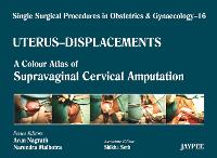 Book Cover for Single Surgical Procedures in Obstetrics and Gynaecology - Volume 16 - UTERUS - DISPLACEMENTS by Arun Nagrath, Narendra Malhotra, Shikha Seth