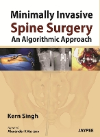 Book Cover for Minimally Invasive Spine Surgery: An Algorithmic Approach by Kern Singh