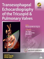 Book Cover for Transesophageal Echocardiography of the Tricuspid & Pulmonary Valves by Poonam Malhotra Kapoor