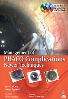 Book Cover for Management of Phaco Complications by Amar Agarwal