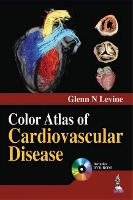 Book Cover for Color Atlas of Cardiovascular Disease by Glenn N Levine