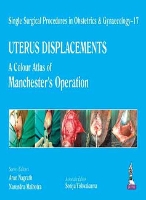 Book Cover for Single Surgical Procedures in Obstetrics and Gynaecology – 17 - UTERUS DISPLACEMENTS by Arun Nagrath