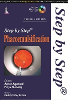 Book Cover for Step by Step Phacoemulsification by Amar Agarwal