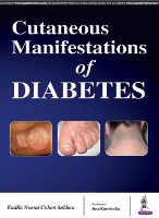 Book Cover for Cutaneous Manifestations of Diabetes by Cohen Sabban Emilia