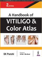 Book Cover for A Handbook of Vitiligo & Color Atlas by S. K. Punshi