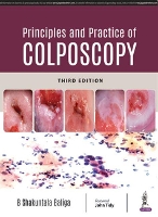 Book Cover for Principles and Practice of Colposcopy by B Shakuntala Baliga