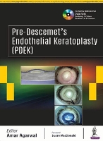 Book Cover for Pre-Descemet’s Endothelial Keratoplasty (PDEK) by Amar Agarwal