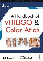 Book Cover for A Handbook of Vitiligo & Color Atlas by SK Punshi