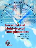 Book Cover for Intestinal and Multivisceral Transplantation by Ernesto P. Molmenti