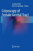 Book Cover for Colposcopy of Female Genital Tract by Sumita Mehta