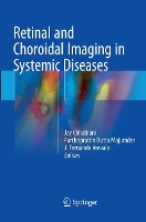 Book Cover for Retinal and Choroidal Imaging in Systemic Diseases by Jay Chhablani